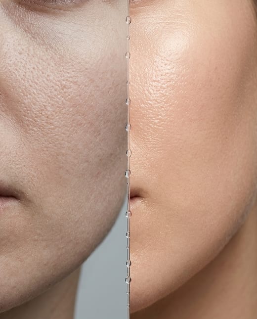 Before and after ad: the same cheek, dull skin, then glowing skin